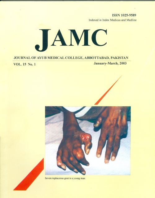 					View Vol. 15 No. 1 (2003): JOURNAL OF AYUB MEDICAL COLLEGE, ABBOTTABAD
				